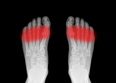 A pair of feet in an x-ray